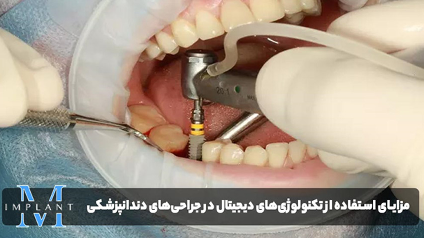 تکنولوژی‌های دیجیتال در جراحی‌های دندانپزشکی