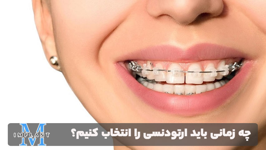 چه زمانی باید ارتودنسی را انتخاب کنیم؟