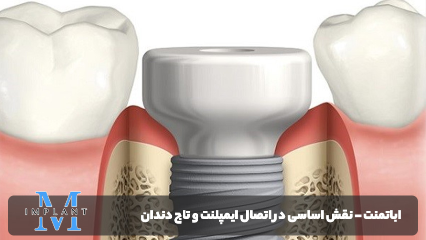 اباتمنت