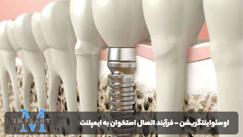 اوسئواینتگریشن