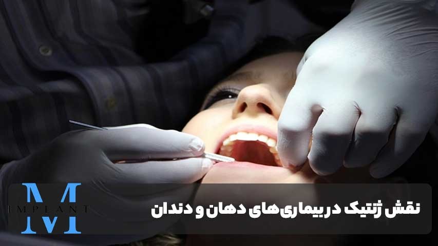 نقش ژنتیک در بیماری‌های دهان و دندان