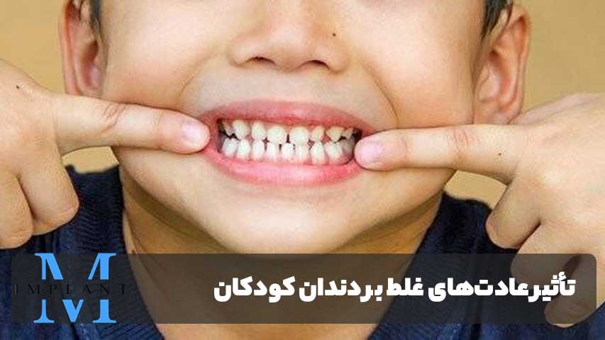 تاثیر عادت‌های غلط بر دندان کودکان