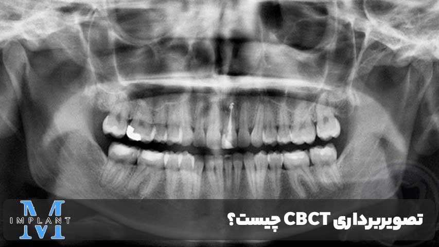 تصویربرداری CBCT چیست؟