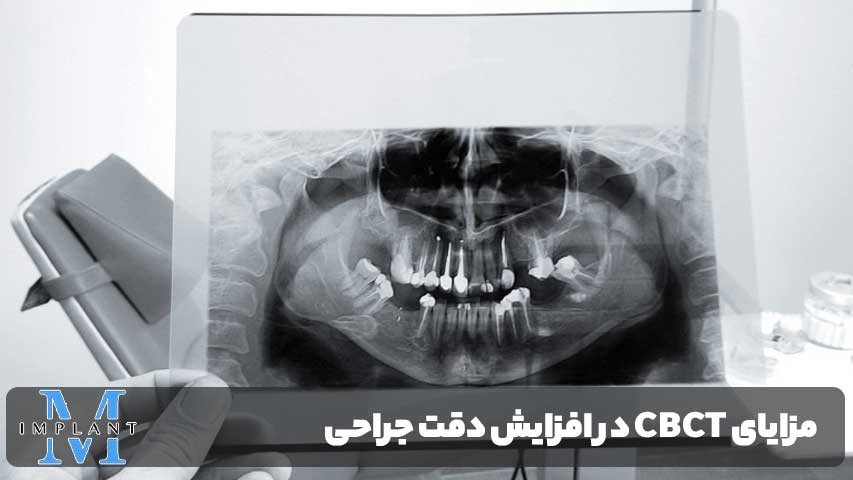مزایای CBCT