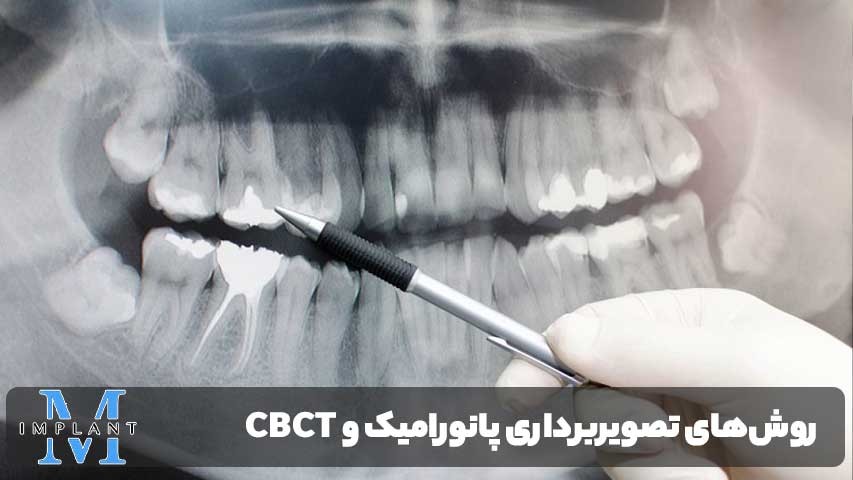 دقت تصویربرداری CBCT
