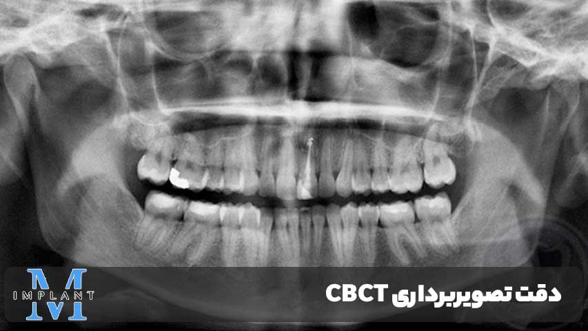 دقت تصویربرداری CBCT