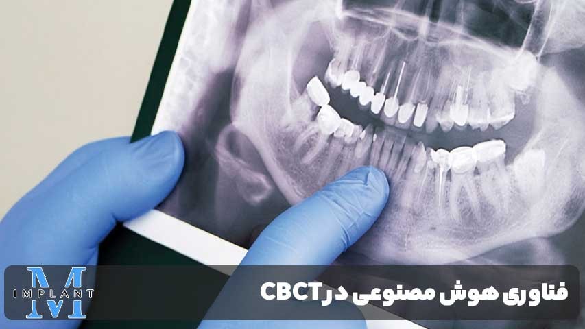 تزریق Intraligamentary
