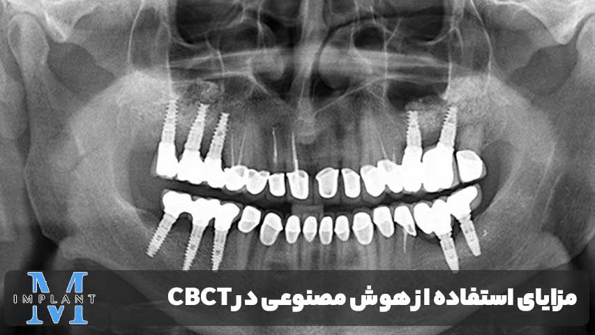 مزایای استفاده از هوش مصنوعی در CBCT