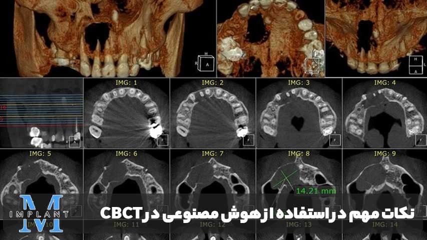 نکات مهم در استفاده از هوش مصنوعی در CBCT